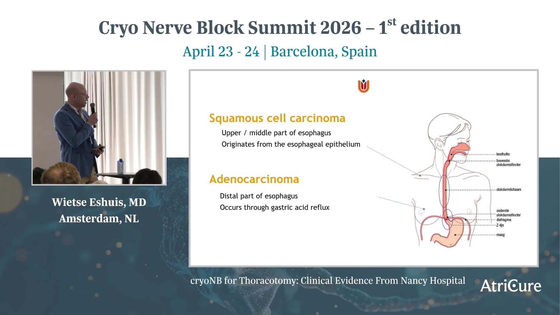 Emerging Patient Population: Application in Esophagectomy